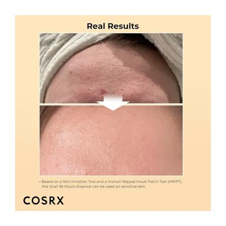 COSRX Advanced Snail 96 Mucin Power Essence 100ml